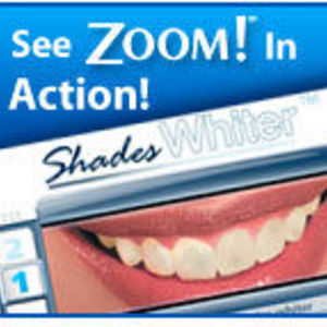 professional zoom teeth whitening