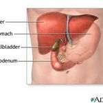 What Should You Expect From An Open Cholecystectomy? (Gallbladder Removal)